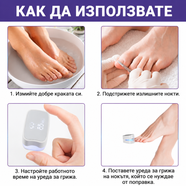 Уред за Лазерно Лечение на Гъбички по Ноктите