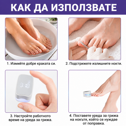 Уред за Лазерно Лечение на Гъбички по Ноктите